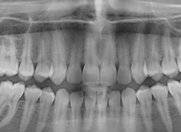 Fusce vulputate eleifend sapien. Vestibulum purus quam