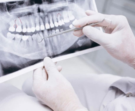 Nombre de Promoción 7