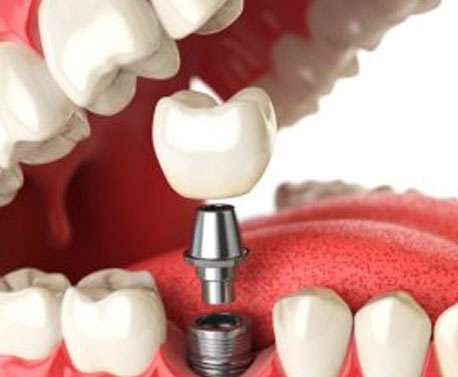 Nombre de Promoción 8