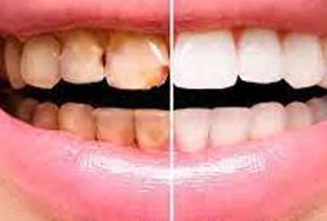 Rehabilitación Oral